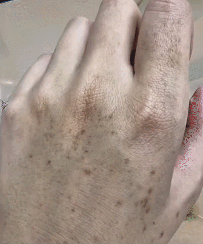 Upgraded anti-freckle essence oil