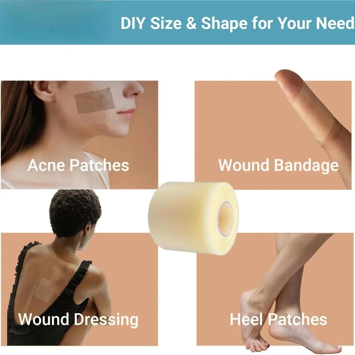 DERMTAPE Hydrocolloid Roll For Acne & Scarring
