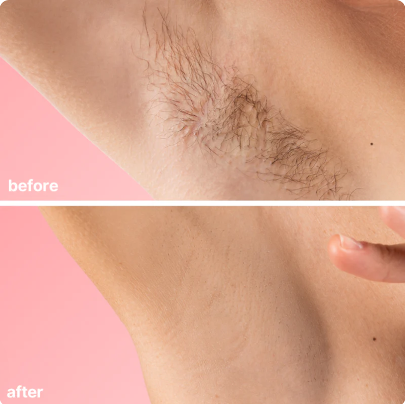 Bare Basics No Shave Hair Removal Cream