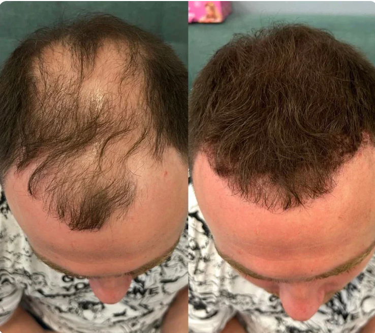 Hairline Line Shadow Contouring Powder