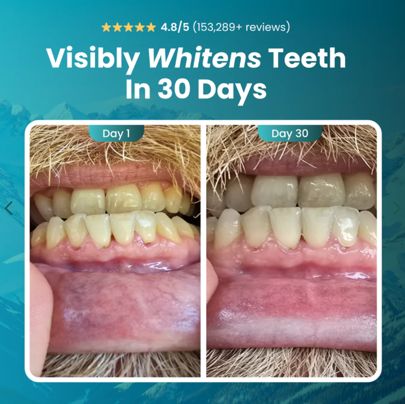 larineco Remineralizing Gum