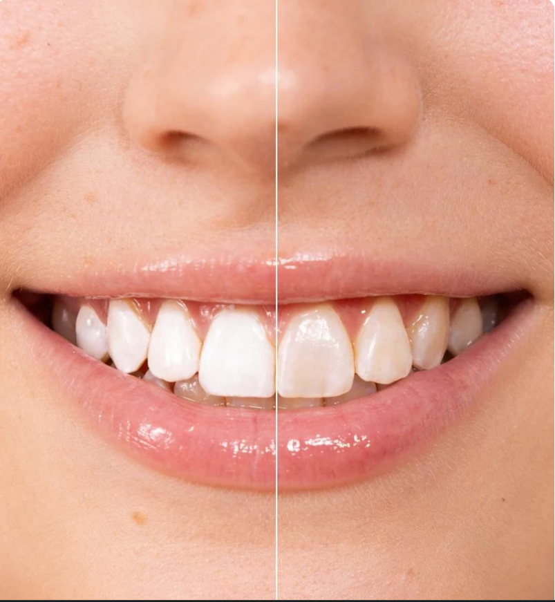 Teeth Polish - Instant White Teeth