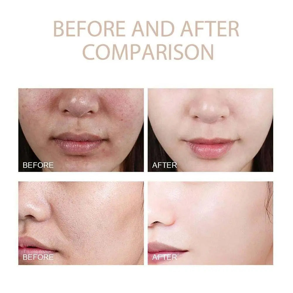 Peel Shot Duo peeling