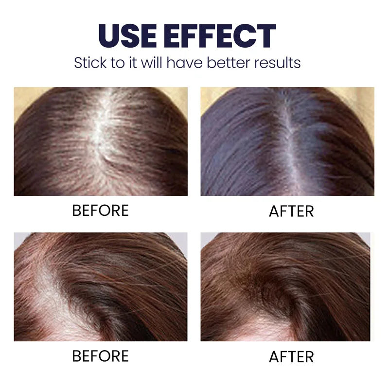 Natural Hair Regrowth Spray