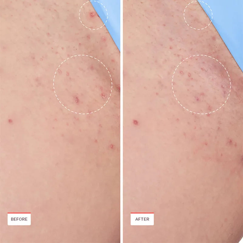 Smoothing Solution Ingrown Hair Treatment