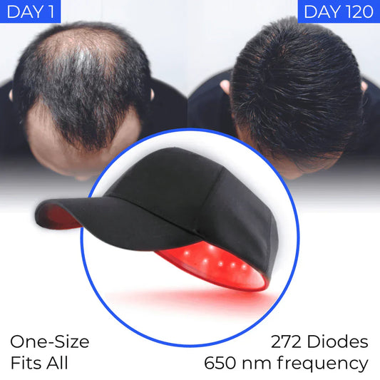 Laser Cap